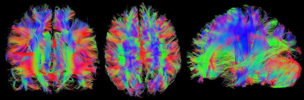 brain, mrt, magnetic resonance imaging